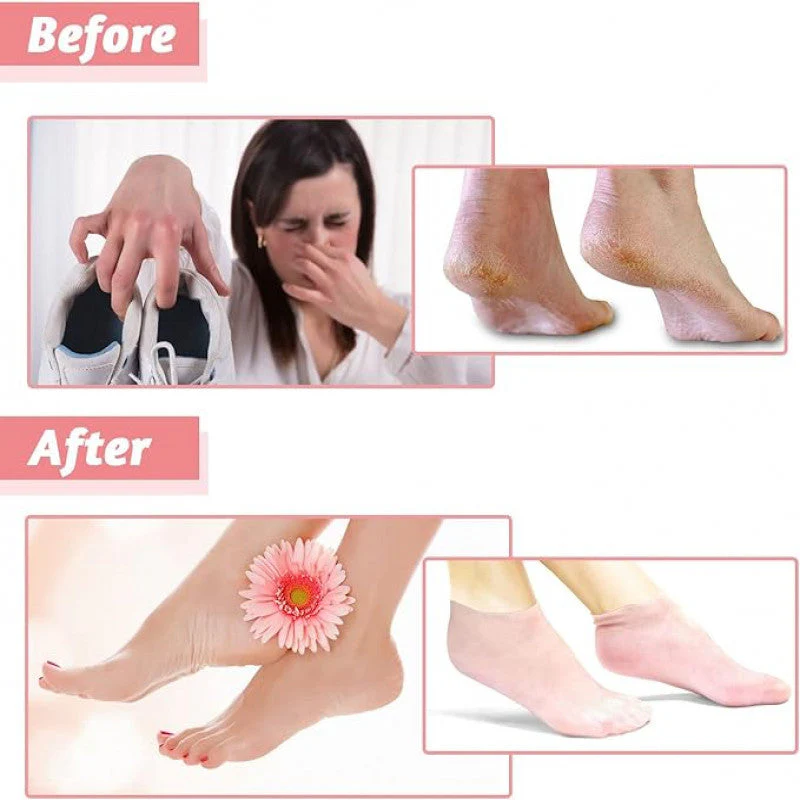 Moisturizing Silicone Socks For Dry Cracked Heels - Image 4