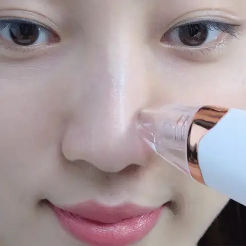 MULTI-FUNCTIONAL BLACKHEAD REMOVER VACUUM TOOL FOR PORE CLEANSING AND ACNE TREATMENT - Image 12