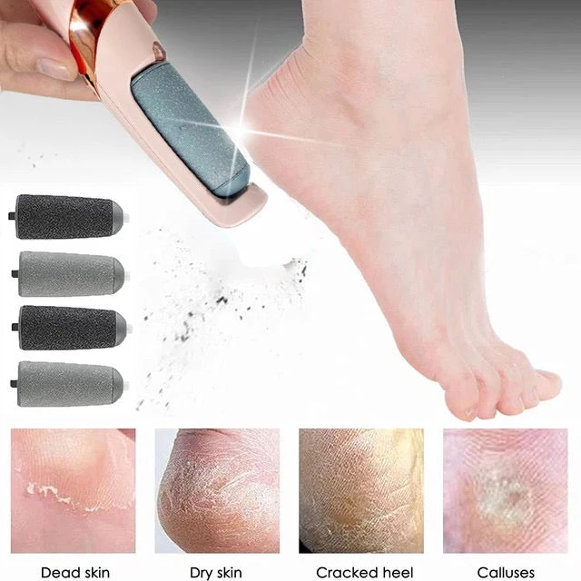 Rechargeable Electric Callus Remover – FREE Extra Roller + USB Charging Wire Included - Image 7